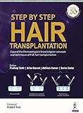 Step by Step Hair Transplantation
