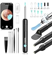 Amazon.co.jp: BEBIRD 耳かき カメラ メカニカルアーム付き 1000W画素