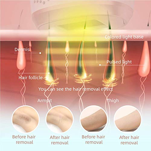 image for AMTOK-US IPL Hair Removal for Women and Man - Permanent & Painless Fac