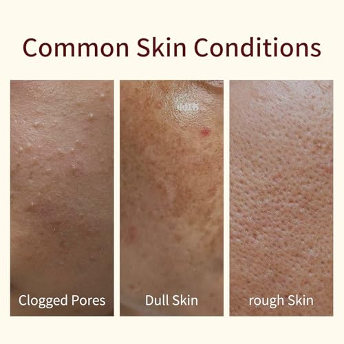 AOPEIBOTO Ground Rice and Honey Glow Face Mask, Face Mask Skincare for Moisturizing, Hydrating, Gentle Exfoliating, 150g/5.29oz