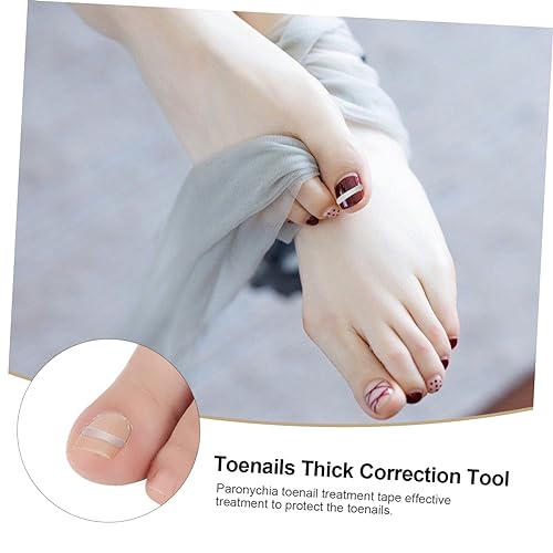 DOITOOL 50 Unidades Postagem Regular Suporte De Pedicure Lado Da Unha Encravada Almofada De Cicatriz