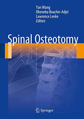 Spinal Osteotomy view 2