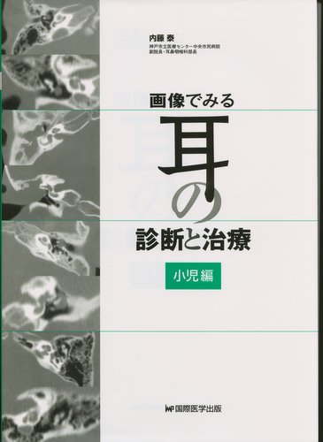 無料電子書籍アプリ 画像でみる耳の診断と治療 小児編 バイ