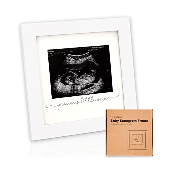 Baby Bilderrahmen für Ultraschallbild – Bilderrahmen Ultraschallbild Baby - Bilderrahmen Schwangerschaft für Werdende…