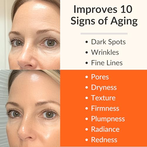 LeVaye Vitamin C Serum, Anti-Aging Face Serum – 15% Vitamin C, Ferulic Acid, Niacinamide, Hyaluronic Acid, Peptides, Ceramides – Targets Wrinkles, Fine Lines, Dark Spots, Enlarged Pores, Dry Skin - Image 4