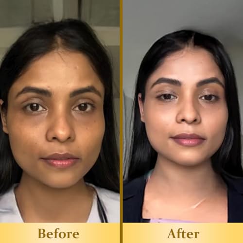 Image of Dr. Veda Under Eye Roll-On Cream for Dark Circles, Puffiness & Fine Lines | Eye Bag Remover | Cooling, Brightening & Hydrating Natural Formula | Anti-Wrinkle | For Men & Women | 10 ml (Pack of 2)