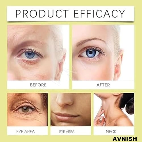 Image of AVNISH Retinal Shot Tightening Booster with 0.1% Retinal, Matrixyl & Niacinamide | Wrinkles & Fine Lines, Pore Minimizer, Firmer Skin, Glow Anti-Aging Night Korean Face Serum Beige Look Younger (15ml)