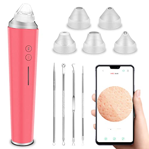 Blackhead Remover Pore Vacuum, WiFi 5.0 Megapixels Visible Facial Pore Cleanser with HD Camera Pimple Acne Comedone Extractor Kit with 6 Suction Heads USB Rechargeable Electric Blackhead Suction Tool