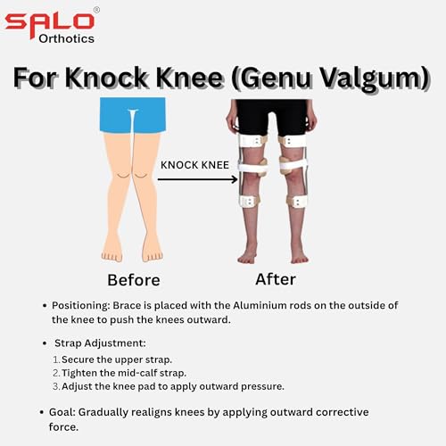 Image of SALO Orthotics Knock Knee & Bow Legs corrector - Genu Valgum Genu Varum Brace (SIZE -Pair of 19 inches)