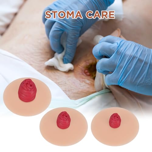 Image of Sticky Ileostomy Simulators, Stoma Training Model Set, Multi-Skin Tone Ostomy Care Practice Models for Medical Training and Patient Education - Light