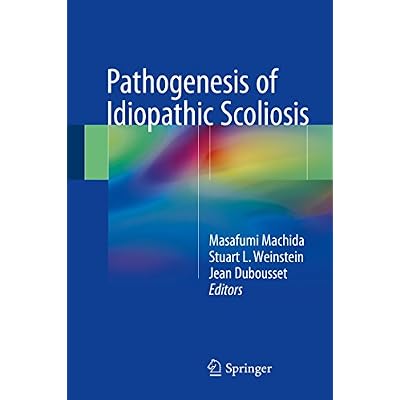 Pathogenesis of Idiopathic Scoliosis
