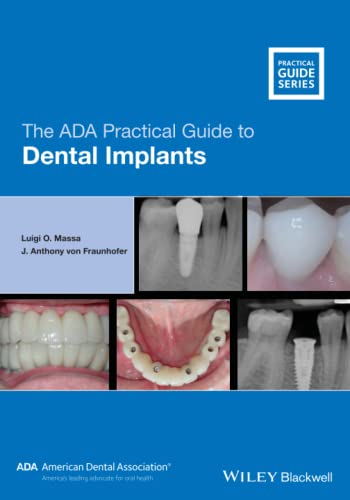 The ADA Practical Guide to Dental Implants view 2