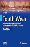 Tooth Wear: An Authoritative Reference for Dental Professionals and Students (BDJ Clinicians Guides)