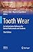 Tooth Wear: An Authoritative Reference for Dental Professionals and Students (BDJ Clinicians Guides)