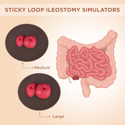 Image of Sticky Loop Ileostomy Simulators, Double-Barrel Stoma Training Model Set, Multi-Skin Tone Ostomy Care Practice Models for Medical Training and Patient Education - Dark