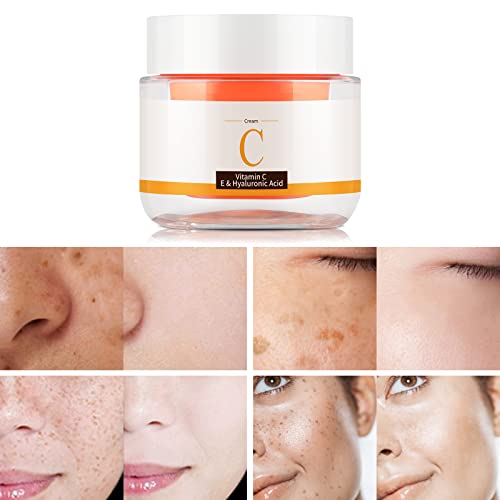 Dark Spot Remover for Face Vitamin C Moisturizer Anti Aging Face Cream Brightening Vit C Moisturizing Daily Cream Facial Moisturizer Dark Spot Corrector for Age Spot Hyperpigmentation Acne Scar-1.8OZ