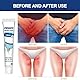 Dark Spot 2Pc Anti-Juckreiz-Creme Für Den Intimbereich Für Männer,Topisch Gegen Juckreiz Anti-Juckreiz-Creme Für Herren,Juckende Körpercreme,Herren-Juckreizcreme,Haut- Und Privatbereich