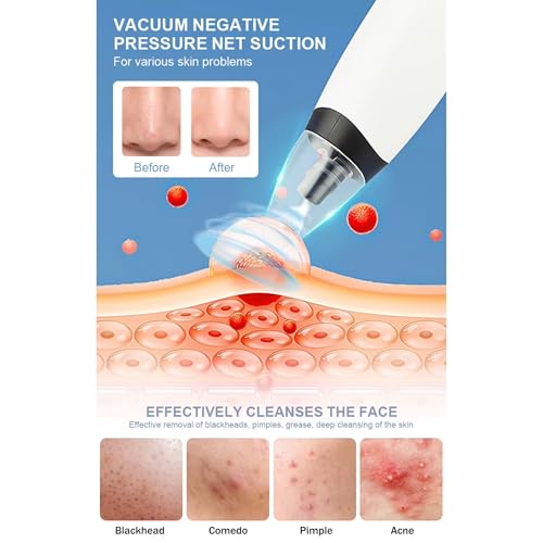 Image of SKYLIGHT Blackhead Remover Vacuum Electric Pore Cleaner for Whitehead Removal Tool, Acne Deep Face Machine, USB Rechargeable Derma Adjustable Suction & Interchangeable Heads Facial Device Men Women