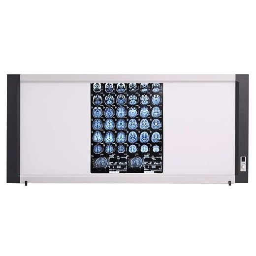 Advanced LED X-ray Viewing Lamp