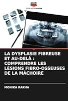 LA DYSPLASIE FIBREUSE ET AU-DELÀ : COMPRENDRE LES LÉSIONS FIBRO-OSSEUSES DE LA MÂCHOIRE (French Edition) 6208727707 Book Cover