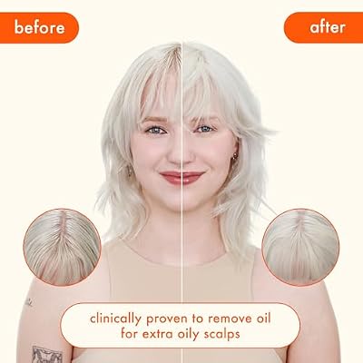 amika perk up ultra oil control dry shampoo | cleans + refreshes scalp + roots, absorbs + helps control oils, extends styles between washes, for all hair types with extra oily scalps