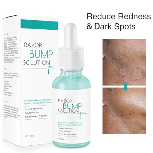Ingrown Hair Reduction Serum,Ingrown Hair Serum For Man and Women,Gentle to Redness And Razor Bump Stopper Solution Dark Spot Corrector After Shave Repair Serum For Ingrown Hair,30ml - Image 7