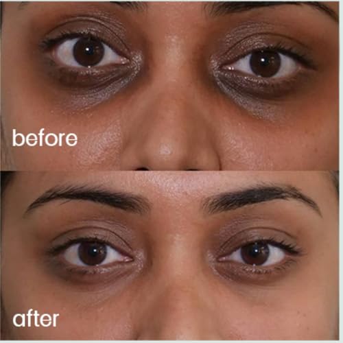 Image of Under Eye Cream I Reduces Dark Circles, Puffiness & Fine Lines | 5% Peptides, 4% Caffeine & 3% Bakuchiol | Brightening & Wrinkles Eye Serum for Men & Women I Visible Results in 14 Days | 15ml