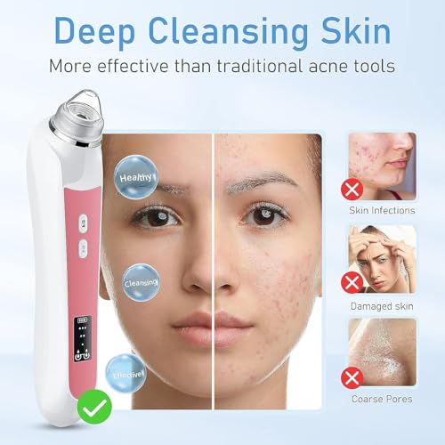 Image of HD Camera USB Blackhead Remover Vacuum, 3 Modes 6 Suction Heads | 1080P lens & 8 LED fill lights, 20x skin magnification, photo & video capture, long-lasting battery, full accessory kit