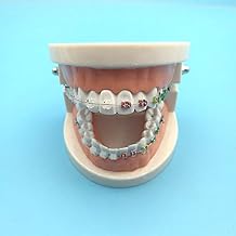 Patient Communication Lab Teach Study Tools - Explaining Models with Braces - Dental 11 Demonstration Orthodontic Treatment Teeth Model - Half Ceramic Half Metal Braces with Archwire