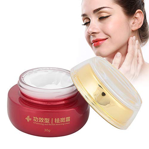 Qkiss Freckles Entfernungscreme 30g, Whitening Spots Removal Moisturizing Repair Gesichtscreme für Ihre Haut