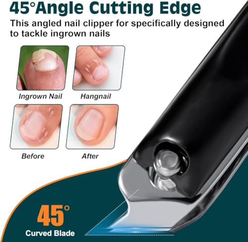 Image of Upgraded 20% Ultra Sharper All-in-One Fingernail and Toenail Clippers, 15% Thicker Sturdy DE-420J2 Stainless Steel, Great Gifts Nail Clippers for Seniors Toe Nail Clippers Case (3-in-1 Black)