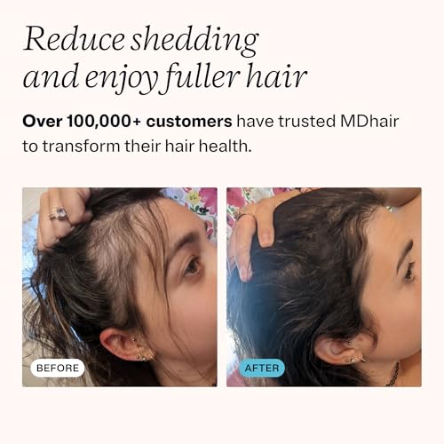Image of MDhair Mounted & Handheld Filtered Showerhead Bundle for Healthier Hair & Skin - Multi-Stage Filter Removes Chlorine & Heavy Metals, Dermatologist-Formulated Shower Head Filter for Hard Water