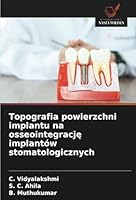 Topografia powierzchni implantu na osseointegrację implantów stomatologicznych 6208651042 Book Cover