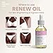 Her Fantasy Box | Renew Her - Natural Rejuvenating Yoni Oil for Dark Spots, Ingrown Hair, and Skin Brightening - Nourishing, Moisturizing Formula for All Skin Types
