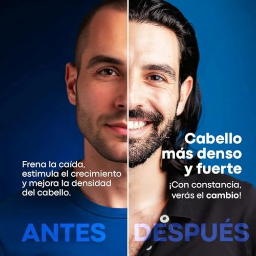 Opiniones y reviews de Minoxidil disponible en línea para comprar. 3 Opiniones y reviews de Minoxidil disponible en línea para comprar. 3