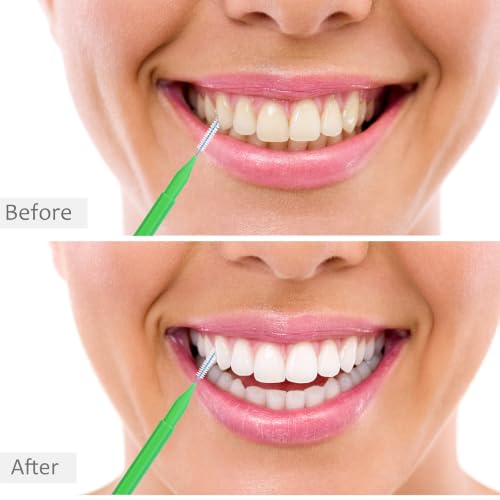 Image of Patelai 100 Pieces Braces Dental Brush for Cleaner Interdental Toothpick Dental Tooth Flossing Head Oral Hygiene Flosser Toothpick Cleaners Tooth Tool(Light Color,Multiple Sizes)