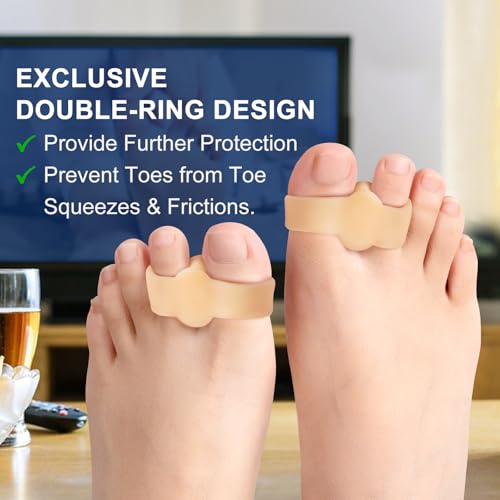 Image of Promifun Gel Toe Corrector, 10 Pack of Toe Separators with 2 Loops, Big Toes Spacer for Bunion Pain and Overlapping Toe - Beige