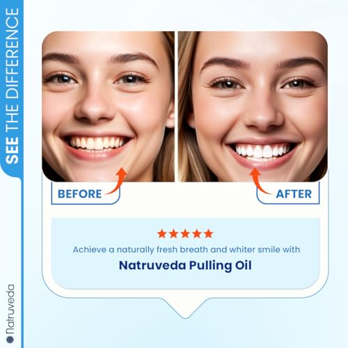 Image of Natruveda Coconut Oil Pulling Mouthwash - Natural Whitening Ayurvedic Rinse | Fresh Mint Blend | Coconut Oil Pulling for Teeth & Gums | Whyte Oil Pulling | Aceite de Coco para Los Dientes -10 oz