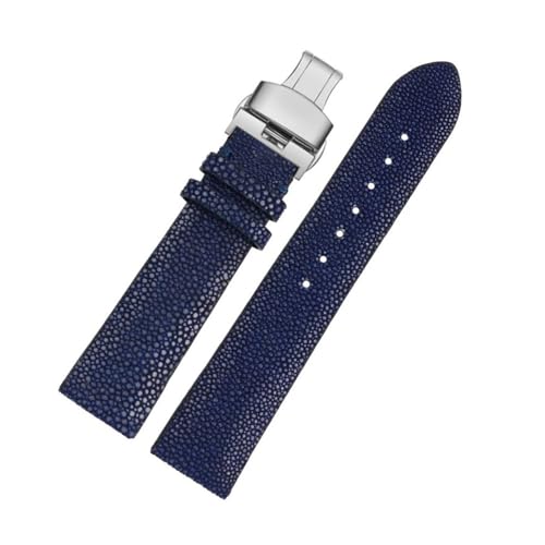 [X] 20mm 22mm p[tBbVXLXgbv́AFit For Huawei ɓK/Fit For TISSOT ɓK/IKɓK/Fit For Mido ɓK jƏ̃frEHb`ANZT[ubNobN(Blue 