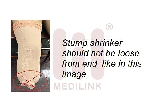 Medilink Above Knee AK Stump Shrinker Sock for Amputee Limb Compression & Post-Surgery Care | Breathable Ventilated Fabric | Reduces Swelling & Promotes Healing | Comfortable Fit, Beige, Extra Large Size 2