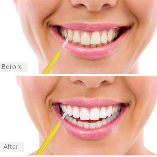 Image of Patelai 100 Pieces Braces Dental Brush for Cleaner Interdental Toothpick Dental Tooth Flossing Head Oral Hygiene Flosser Toothpick Cleaners Tooth Tool(Pink,Purple, Yellow,Mixed Size)