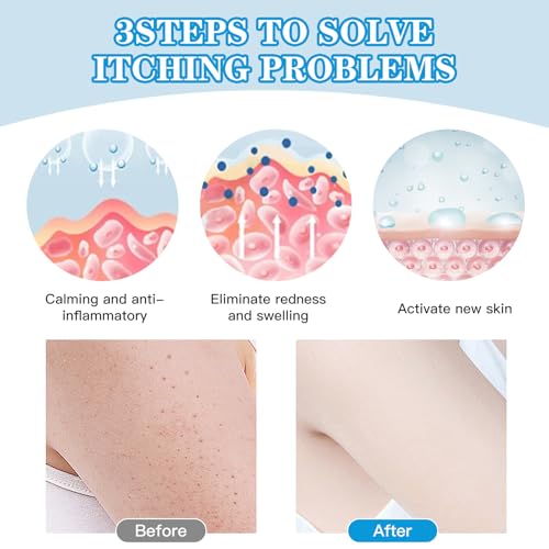 Bettinay 2PCS Soothing Ointment, Natural Herbal Ointment Skin Cream for Skin Itching, Dry Itchy, Rough Peeling - Image 4