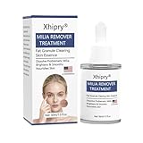 Milia Remover for Face, Milia Bump Remover Under Eye, Spot Treatment Serum with Salicylic Acid, Milia Acne Cream 30Ml