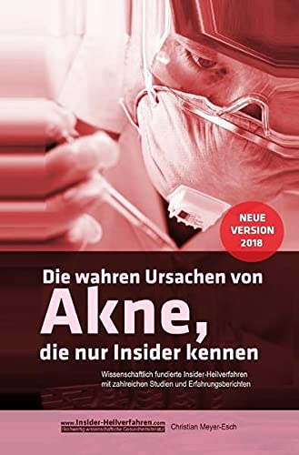 Preisvergleich Produktbild Die wahren Ursachen von Akne, die nur Insider kennen