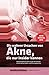 Produktbild Die wahren Ursachen von Akne, die nur Insider kennen