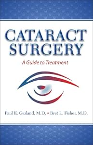 Vedi scheda su Amazon Cataract Surgery: A Guide to Treatment