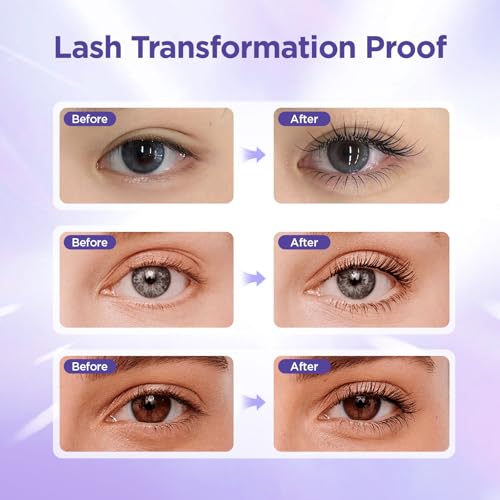 Lash Serum | Advanced Eyelash Growth Formula with Nourishing Botanical Extracts, Gentle Eye Treatment for Longer, Fuller & Thicker Natural Lashes, Vegan & Cruelty-Free — view 4