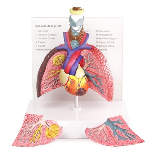 Image of HADWYN Human Respiratory System model,anatomy models human body