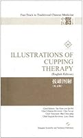 Illustrations of Cupping Therapy by Tao Xianyue,English,2009 7532399532 Book Cover