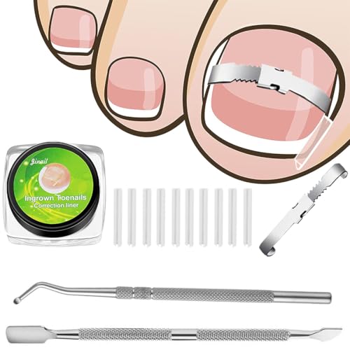 BLPRKOT Corrector Uñas Encarnadas Uñas Encarnadas Uñas Encarnadas Pies Ongles Incarnés Correcteur Ongle Incarné Tratamiento De Uñas Encarnadas Alivio Del Dolor De Acero Inoxidable Herramienta